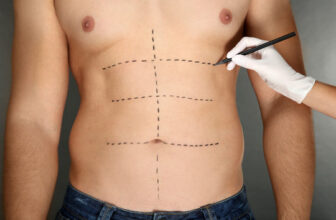 Liposuction Riyadh