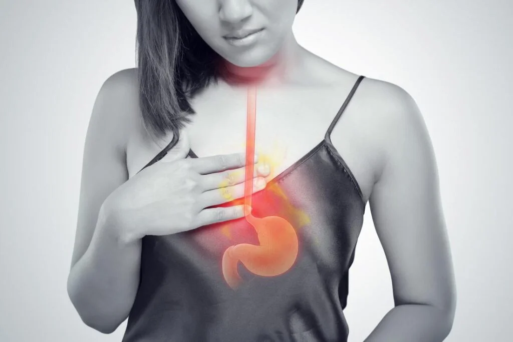 Why Acid Reflux Treatments Don’t Always Work for Swallowing Problems