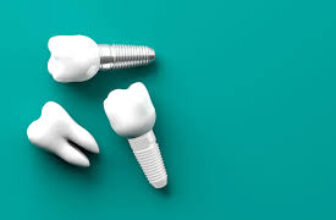 Titanium vs. Zirconia Implants: Which Material Is Better?
