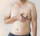 Gynecomastia Surgeon in Navi Mumbai: Expertise You Can Trust