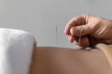The Role of Acupuncture in Pain Management: A Possible Alternative to Medication