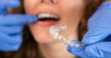 5 Reasons Invisalign Beats Traditional Braces