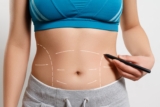 A Comprehensive Guide to Mini Tummy Tuck Surgery in Dubai