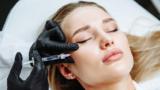 Achieve a Soft and Natural Lift with Cheek Fillers