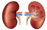 Advancements in Simple Nephrectomy Procedures in Dubai