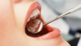 Affordable Dentist Visit: What to Expect
