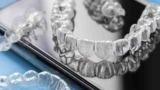 Affordable Orthodontic Treatment Geneva