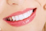 Are There Any Side Effects of Teeth Whitening in Dubai