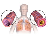 Asthma Specialist in Mumbai: Expert Respiratory Care