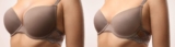 Understanding Breast Reduction and Body Image