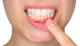 How to Cure Gum Disease: Effective Treatments and ProDentim Reviews