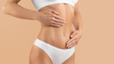 Best Tummy Tuck Techniques for a Flatter Stomach