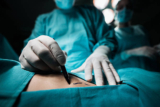 BodyTite in Dubai: Top Areas of the Body You Can Transform