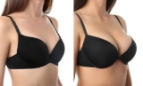 Can Breast Augmentation Affect My Natural Breast Sensation