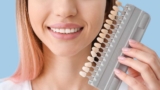 How Dental Veneers Can Fix Chipped or Broken Teeth