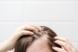 Can Finasteride Be Used at a Low Dose for Hair Loss?