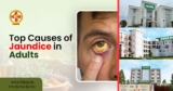 Top Causes of Jaundice in Adults and How to Manage Them
