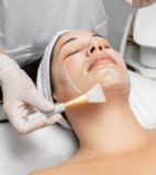 What to Expect After a Chemical Peel: Post-Treatment Care and Recovery?
