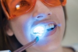 Combining Zoom Teeth Whitening with Other Cosmetic Dental Treatments