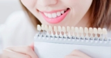 Composite Veneers for a Wedding-Ready Smile