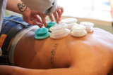 Experience Safe and Effective Cupping Therapy Philadelphia