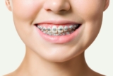 Are Braces Safe for People With Sensitive Teeth?