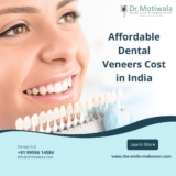 Complete Guide on Dental veneers Cost in India