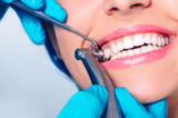 Teeth Cleaning and Its Impact on Your Social Confidence