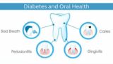 The Impact of Diabetes on Oral Health