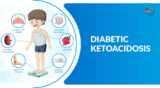 Diabetic Ketoacidosis – Symptoms & Causes