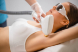 The Process of Electrolysis Laser Hair Removal Explained in Detail