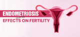 ENDOMETRIOSIS AND ITS EFFECTS ON FERTILITY