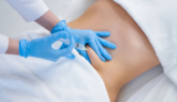 Fat Melting Injections A Safe Path to a More Sculpted Figure
