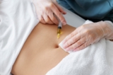 Fat Melting Injections vs. Liposuction: Which Is Right for You?