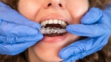 Find the Best Orthodontist in Geneva Today
