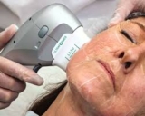 HIFU Treatment: An Effective Approach to Skin Tightening Explained