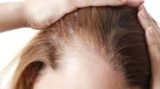 Looking for Hair Transplant Options? Riyadh Has You Covered!
