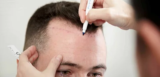 From Thinning to Thriving Hair Transplants in Dubai