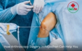 How Arthroscopy Surgery in Rajasthan Can Help You