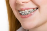 How Do You Clean Your Dental Retainer to Prevent Bacteria Build-Up