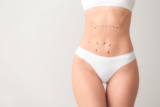 How Long Does It Take to Recover from a Tummy Tuck in Dubai