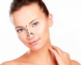 How Rhinoplasty Helps Achieve Natural, Proportional Results?