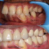 Best Dental Hospital Coimbatore