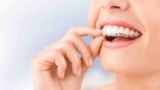 Invisalign for Adults: A Discreet Way to Fix Your Smile