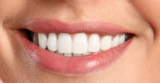 Is Teeth Whitening Right for People with Crowns or Fillings?