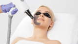 Laser Carbon Peel Your Secret to Flawless Skin