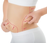 The Importance of Patient Satisfaction in Liposuction Surgery