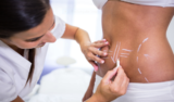 Everything You Need to Know About Liposuction Surgery