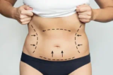 The Pros and Cons of Liposuction Surgery in Dubai