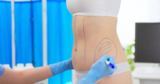 Liposuction Surgery in Dubai: Truths About Fat Removal and Results